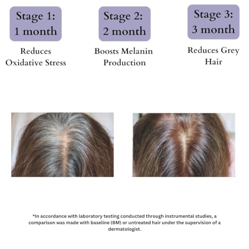 Image of BLUSHLIN 2% Darkenyl for Anti-Greying Hair Serum | Hair Growth Actives with Biotin, Bhringraj, Henna & Amino Acid Complex | Strengthens Roots & Adds Shine | Toxin Free | All Hair Types (10ml, 10.0, millilitre)