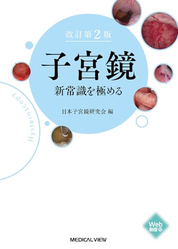 子宮鏡　新常識を極める−改訂第２版