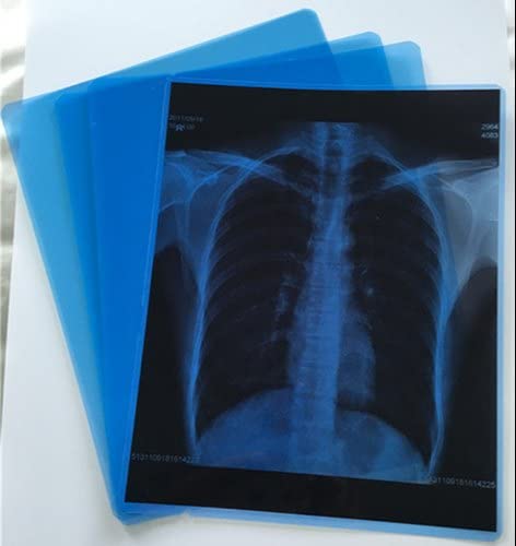 Image of Dhawni Xray Inkjet Medical Film Blue Basefor X Ray imaging /Waterproof Film /SIZE: 210mm x 297mm (A4) X 50 Sheet Pack of 280 GSM / 210 Micron