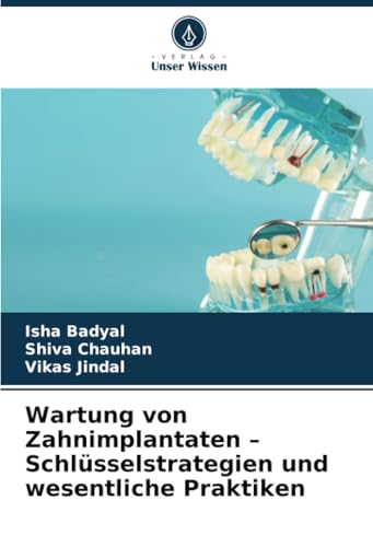 Wartung von Zahnimplantaten - Schlüsselstrategi... [German] 6208779588 Book Cover