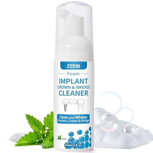 Dental Implant Cleaner, Cleans & Whitens Implants, Crowns, Bridges &