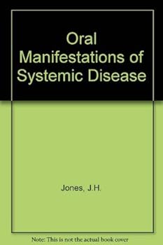 Hardcover Oral Manifestations of Systemic Diseases Book