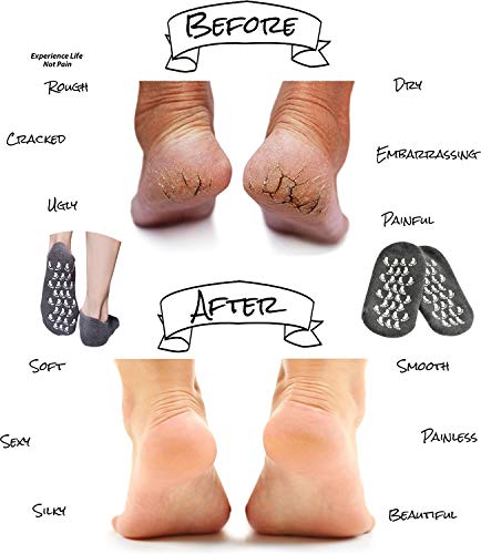 Moisturizing Socks And Gloves, Gel Socks Soft Moisturizing Socks, Gel Spa Socks For Repairing And Softening Dry Cracked Feet Skins And Hand, Gel Lining Infused With Essential Oils And Vitamins #TOP2