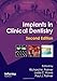 Implants in Clinical Dentistry
