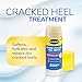 Dr. Scholl's Severe Cracked Heel Repair Restoring Balm 2.5oz, with 25% Urea for Dry, Cracked Feet, Heals and Moisturizes for Healthy Feet