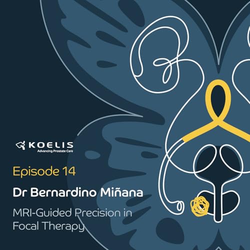 MRI-Guided Precision in Focal Therapy