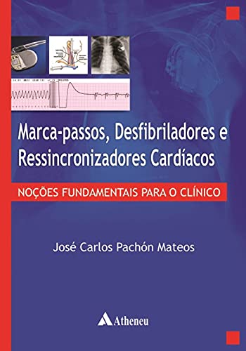 Marca-passos, Desfibriladores e Ressincronizadores Cardíacos: Noções Fundamentais Para o Clínico