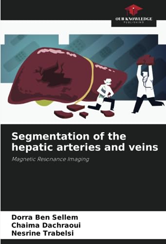 Segmentation of the hepatic arteries and veins: Magnetic Resonance Imaging