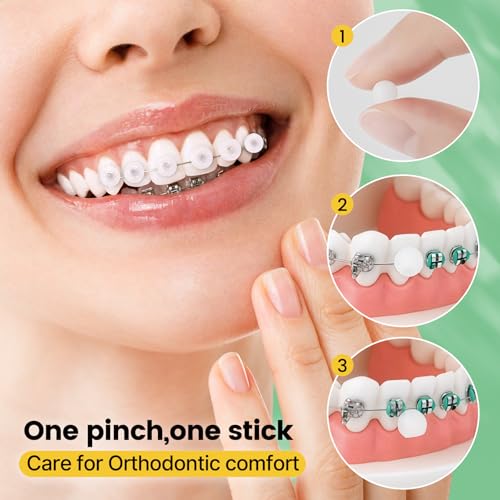 Zahnschutz-Wachs für mehr Komfort mit Zahnspangen - 120 Stücke einzeln verpackte Dots mit Minze, für die tägliche Zahnspangen-Pflege