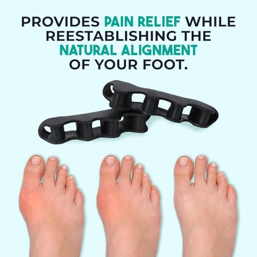 Image of Toe Separator for Feet Toe Spacers Correct Toes Yoga Silicone Hammer Toe Corrector for Women & Men Correct Toe Straighteners for Overlapping Toes (All Finger Toe Separator) (BLACK)