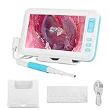 ハンドヘルド耳かき耳内視鏡のピック