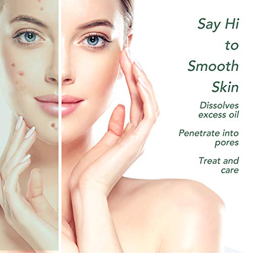 Akne Behandlung Anti Akne Spot Pickel Creme Makel Breakout Behandlung Gesicht Akne Narbenentfernung Gel-Creme reduziert Rötungen natürliche Hautpflege (60 g) - Image 4