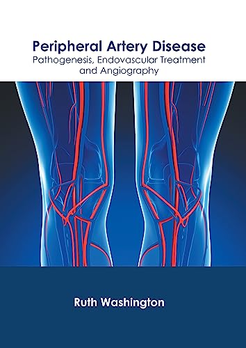 Peripheral Artery Disease: Pathogenesis, Endovascular Treatment and Angiography