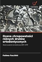 Ocena chropowatosci róznych drutów ortodontycznych: Wykorzystanie kontaktowej SEM i AFM (Polish Edition) 6208712378 Book Cover