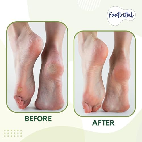 Footvital Pumice Stone for Feet, Foot Exfoliator Scrubber, Callus Remover, Made of Natural Terra-Cotta, Exfoliates & Smooths Rough Skin (Pack of 2) 3
