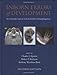 Inborn Errors of Development (Oxford Monographs on Medical Genetics)