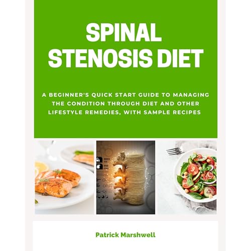 Spinal Stenosis Diet: A Beginner's Quick Start Guide to Managing the Condition Through Diet and Other Lifestyle Remedies, With Sample Recipes by Patrick Marshwell episode artwork