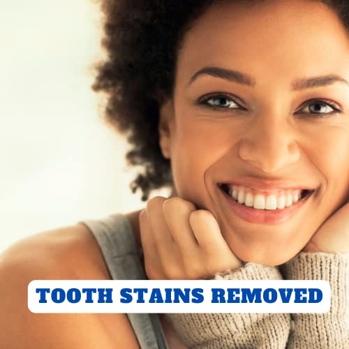 Teeth Whitening Gel for Trays 5 Pcs Fast Acting Teeth Whitening Gel Refill with Strongest 44% Carbamide Peroxide Gel, 2 Bleach Trays Included for Teeth, Enamel Safe, Gluten Free and Vegan - Image 4