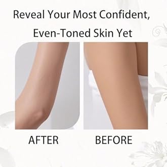 Mad White Underarm Cream, VC Antioxidant Skin Lightening Cream, Summer Whiten Moisturizer Lotion For Dark Underarms, Knees, Elbows & Bikini Line Intimate Areas (1)