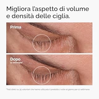 The Ordinary Multi-Peptide Lash and Brow Serum, Siero occhi, Formula a base di peptidi per ciglia e sopracciglia più folte e voluminose, 5ml