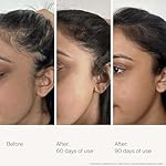 Living Proof Scalp Care Density Serum - Image 2