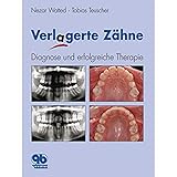 kfo limburg  Verlagerte Zähne: Diagnose und erfolgreiche Therapie
