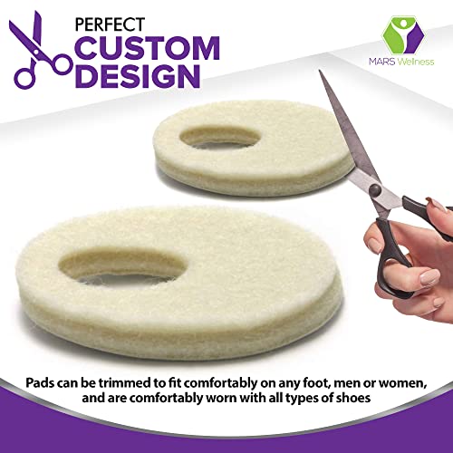 Oval Shaped Felt Callus Protective Pads - Adhesive Foot Pads That Surround Calluses From Rubbing On Shoes - 1/8" - 25 Pack #TOP3