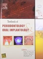 Textbook of Periodontology and Oral Implantology 8131210596 Book Cover