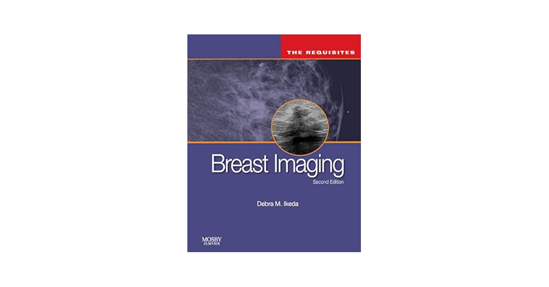 Breast Imaging (The Core Requisites): 9780323051989