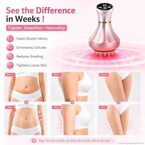 Image of 4-in-1 Lymphatic Drainage Massager - Anti-Cellulite Message Tool with Heating /Vibration /Light Therapy, Full Body Pain Relief & Skin Tightening,Cordless Handheld for Sciatica