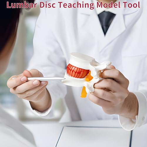 Image of Human Anatomical Lumbar Disc Herniation Model, 1.5 Times Life Size Lumbar Vertebrae Disc Herniation Model, Portable Lumbar Spine Model for Medical, Teaching and Demonstrating