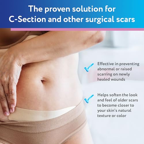 ScarAway Advanced Silicone Scar Sheets for C-Section, Reusable Strips (1.5” x 7”) for Hypertrophic and Keloid Scars from C-Section & Other Surgeries, 4 Sheets