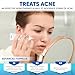 AOBBIY Azelaic Acid Acne Cream Azelaic Acid For Face: Premium Azelaic Acid Cream - Face Skin and Beauty Care - Azelaic Acid Facial Cream, 30mL