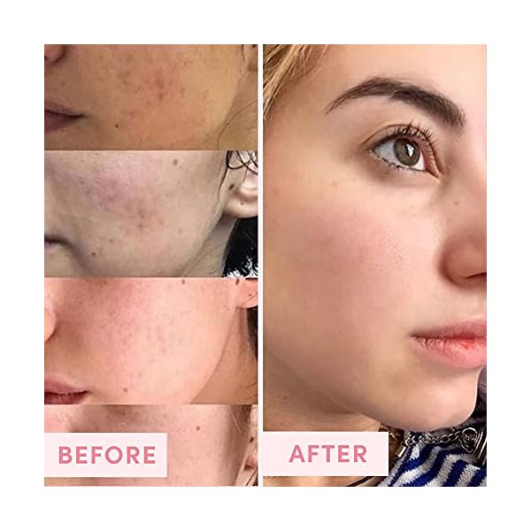 Sand & Sky Australian Pink Clay Porefining Mask for Blackheads. Evens skin tone.