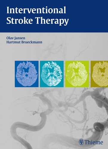 Interventional Stroke Therapy: Diagnostic Imaging and Endovascular Management