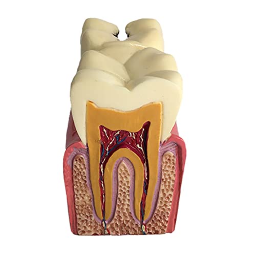 Modèles dentaires : étude comparative de six cas de caries pour la recherche