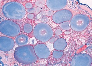 3B Scientific GmbH W13033 Crustacean Micro. Slides/Set of 10, Grade: 1 to 2