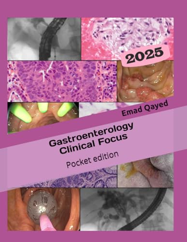 Gastroenterology Clinical Focus - Pocket edition: High yield GI and hepatology review - in your pocket!