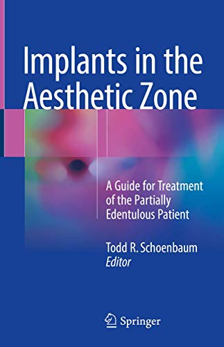 Implants in the Aesthetic Zone: A Guide for Treatment of the Partially Edentulous Patient