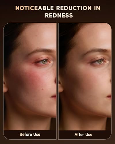 Red Light Therapy Mask for Face, 4 Modes Wireless Remote LED Face Mask Light Therapy, 850nm Near-Infrared & Red Light, 272 LEDs, Anti-Aging Skin Rejuvenation Device for Home or Travel Gift for Women — view 6