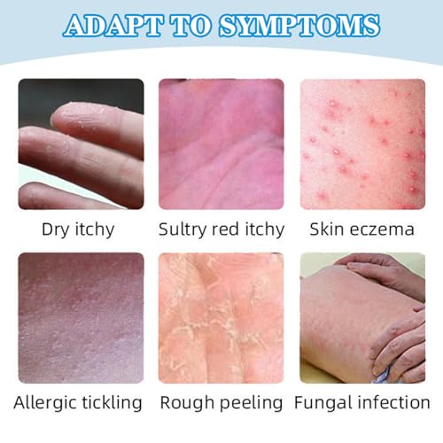 Bettinay 2PCS Soothing Ointment, Natural Herbal Ointment Skin Cream for Skin Itching, Dry Itchy, Rough Peeling - Image 3