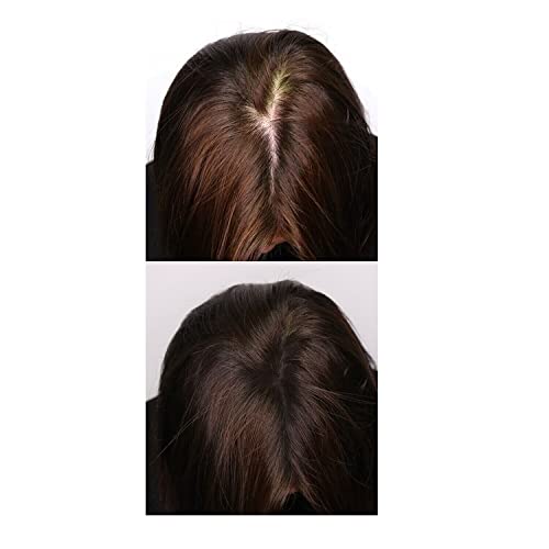 Makeitfull Hair Building Fiber Compatible With Toppik Hair Fibers Make It Full Premium Fibers (Black 27.5G Large Size), 1.0 Count #TOP6