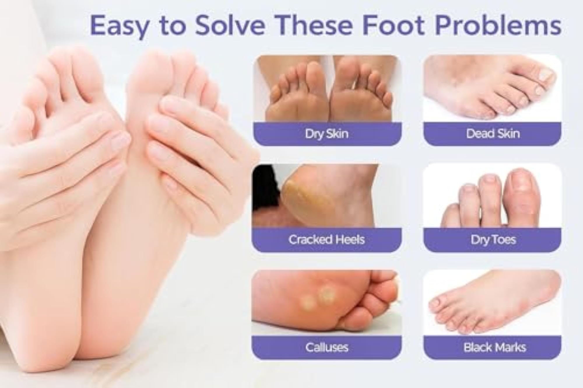 Foot Peel Mask, Exfoliating Treatment for Dry Cracked Heels