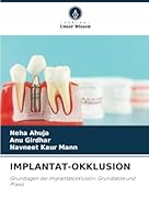 IMPLANTAT-OKKLUSION: Grundlagen der Implantatokklusion: Grundsätze und Praxis (German Edition) 6208715709 Book Cover