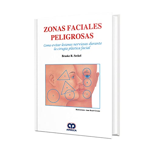 ZONAS FACIALES PELIGROSAS. COMO EVITAR LESIONES NERVIOSAS