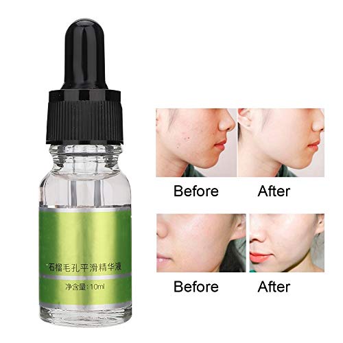 ANGGREK dei pori dei pori Riduzione del viso