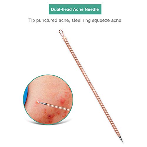 Romacci 4 unidades / conjunto Kit de ferramentas para agulhas de remoção de cravos pretos Clipe de a