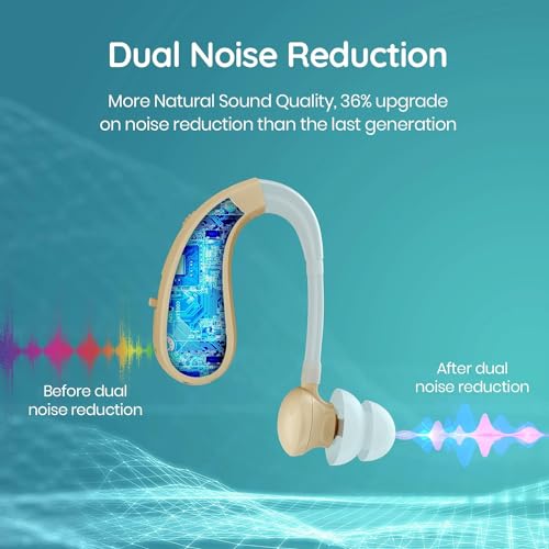 Image of Aika AV-8202 Rechargeable Hearing Aid Amplifier Machine For Old Age, Digital BTE Model with Dual Noise Reduction (1Piece, Beige, For Single Ear), 1 Dry Kit Free