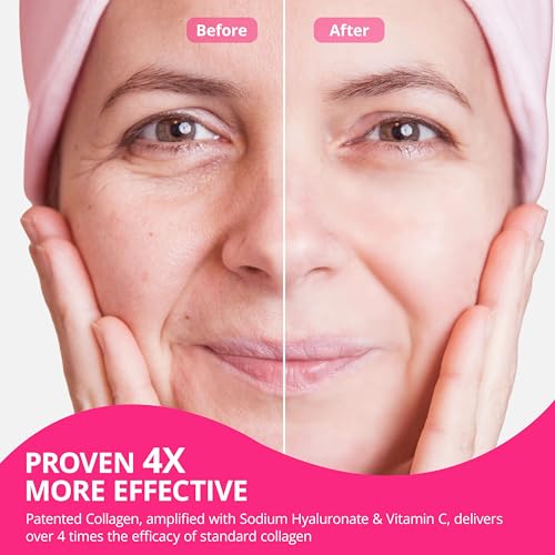 Image of Collagen Powder for Women, Collagen Peptides Powder with Probiotics, Prebiotic Collagen Protein for Skin, Hair, Bone & Joint | 16-in-1 Sugar-Free Formula, Unflavored