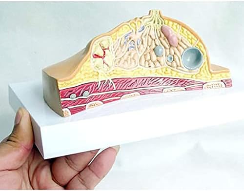 Modelo anatômico de estrutura de perfil de mama feminino, modelo de anatomia de doença de câncer pat
